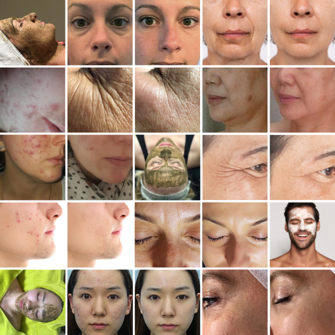2B Bio Peeling antes y después 660×660 1